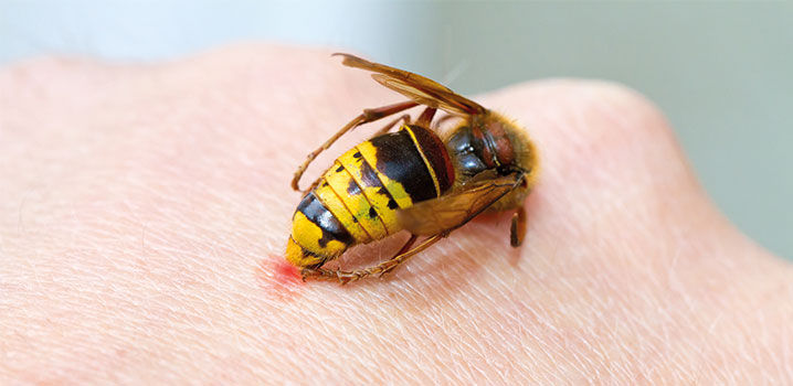 Unsere Tipps bei Insektenstichallergie