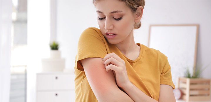 Was tun bei Insektenstichen?