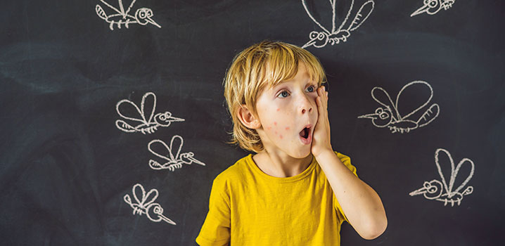 Unsere Tipps bei Insektenstichen