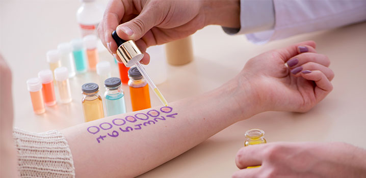 Unsere Empfehlung für die Diagnose einer Allergie