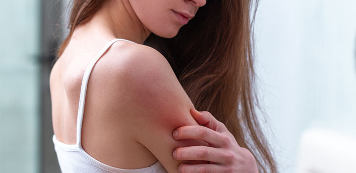 Atopische Dermatitis