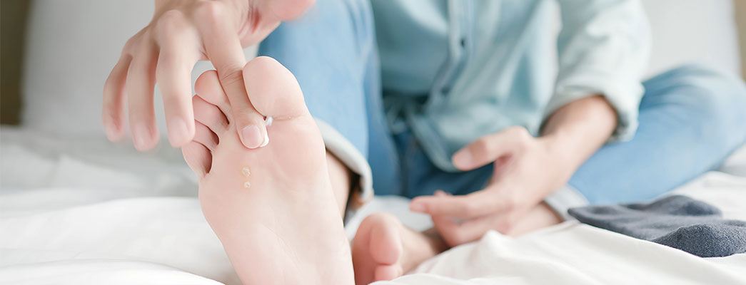 Dem Fußpilz auf der Spur